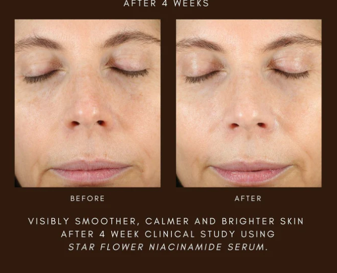 Travel: Star Flower Niacinamide Serum 20ml